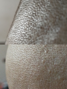 Бритва для головы Rowenta GentleBald TN3110E0 отзыв 4