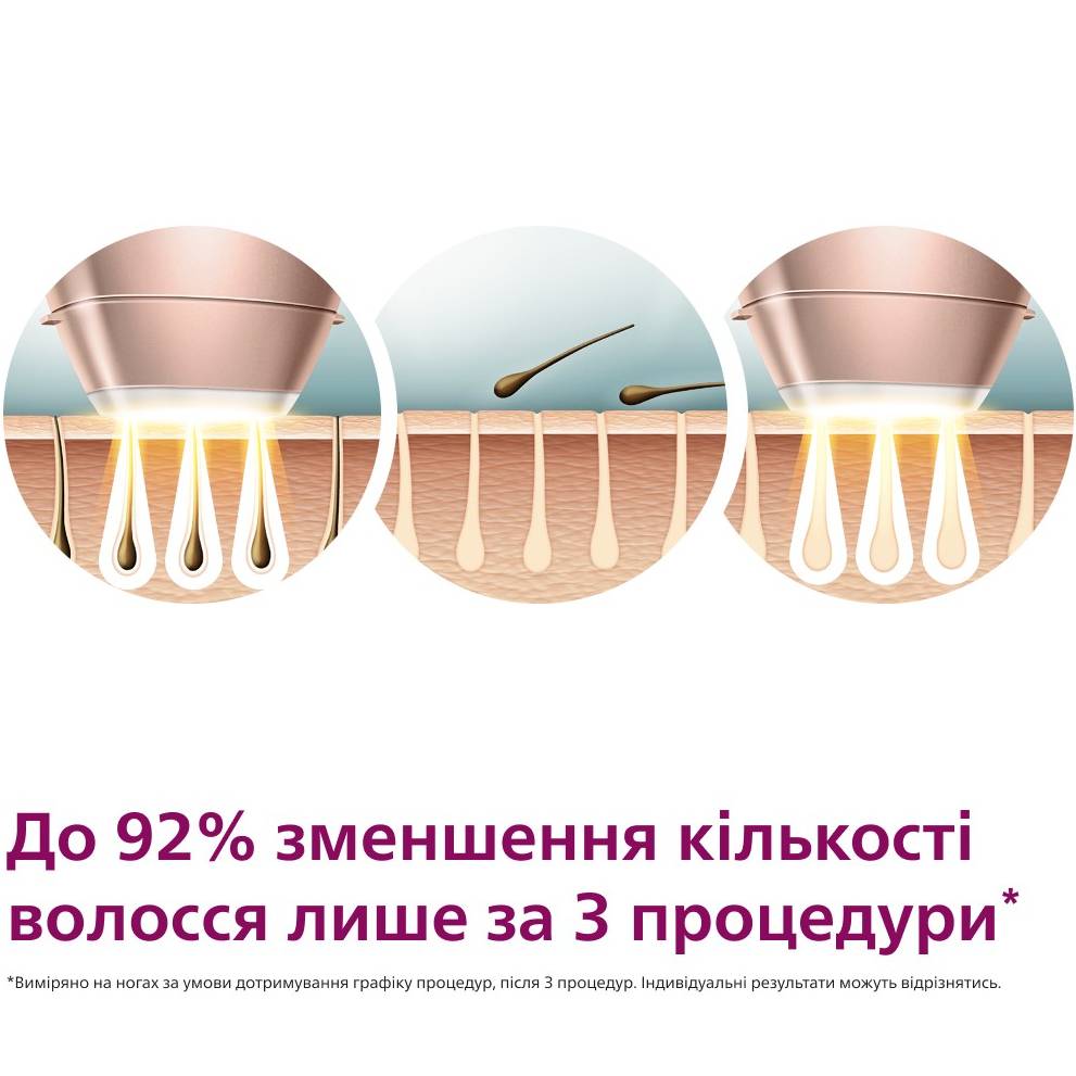 Фотоепілятор PHILIPS Lumea BRI977/00 Освітлювана поверхня 4.1