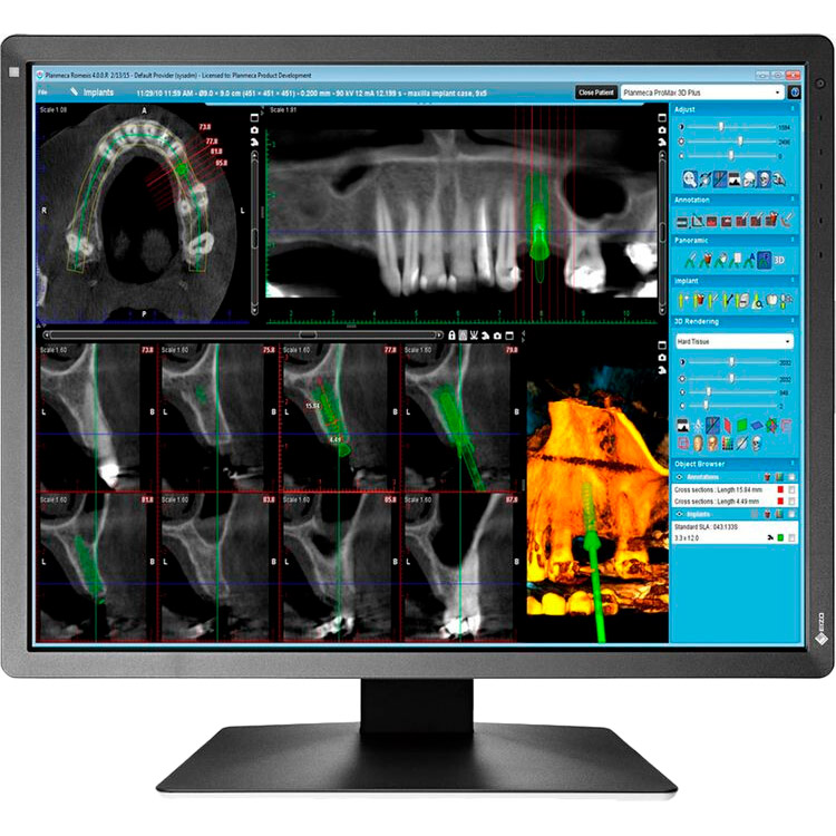 

Монитор EIZO MX216-SB, MX216-SB
