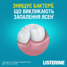 Ополіскувач для ротової порожнини Listerine Expert "Захист ясен", 250 мл (5010123703509)