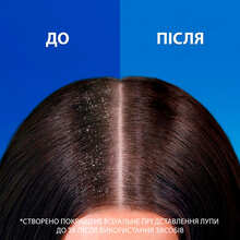 Шампунь HEAD & SHOULDERS Pro-Expert 7 Стойкий контроль с маслом чайного дерева 250 мл (8700216156882)