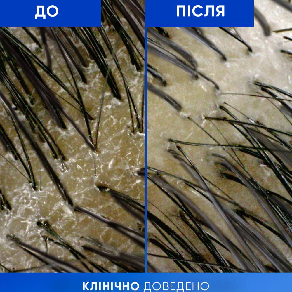 Изображение Шампунь Head & Shoulders Clarify & Shine Очищение и блеск 400 мл (80820713)