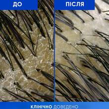 Шампунь Head & Shoulders Clarify & Shine Очищение и блеск 400 мл (80820713)